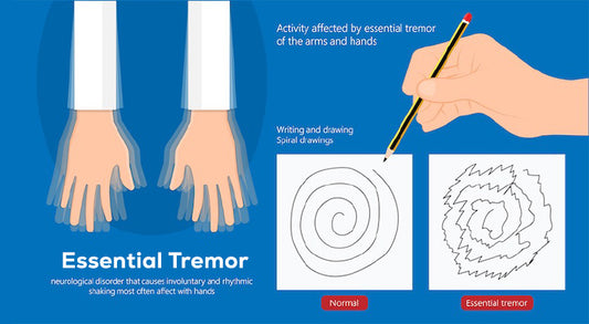  This image shows the effects of essential tremors on hand movement, comparing normal and tremor-affected spiral drawings, highlighting involuntary shaking during activities.