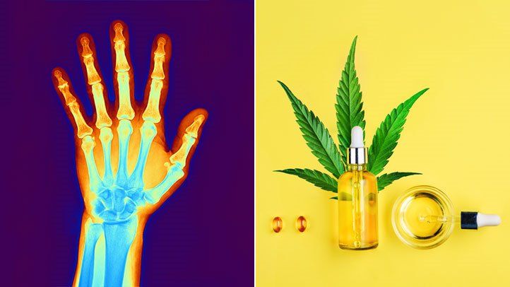 Understanding Arthritis: Can Full Spectrum CBD Offer Relief?